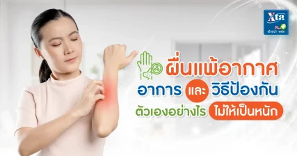 ผื่นแพ้อากาศ ป้องกันอย่างไร