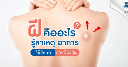 ฝี คืออะไร? รู้สาเหตุ อาการ วิธีรักษา และการป้องกันด้วยตัวเอง