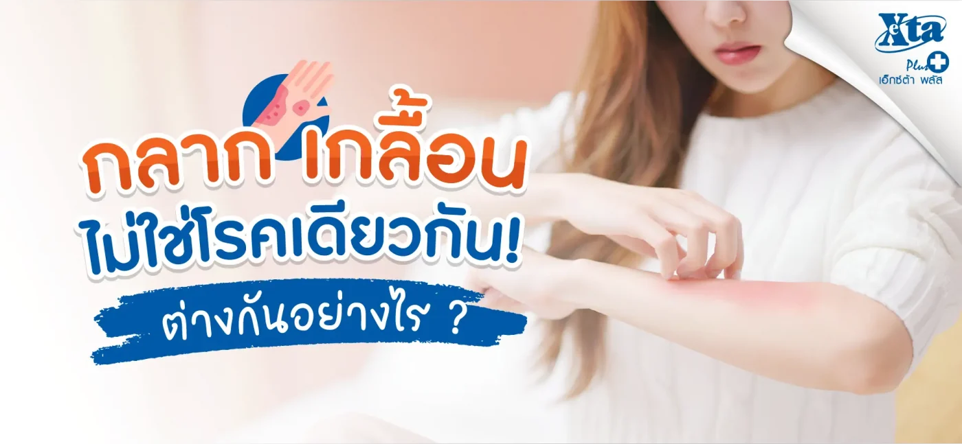 ไขข้อเข้าใจผิด! กลาก เกลื้อน ไม่ใช่โรคเดียวกัน ต่างกันอย่างไร