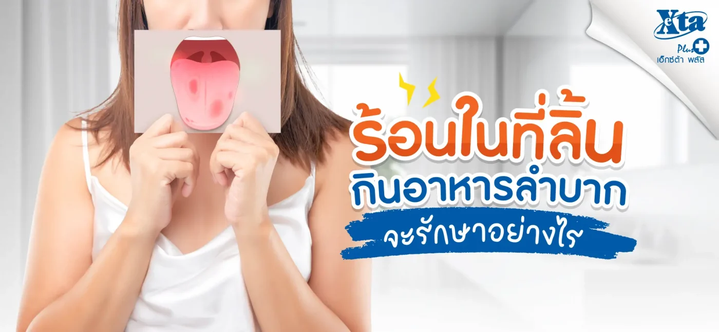 ร้อนในที่ลิ้น กินอาหารลำบาก จะรักษาอย่างไร